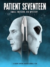 Пациент номер семнадцать (2017) Смотреть онлайн