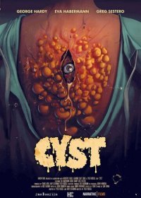 Киста (2020) Смотреть онлайн